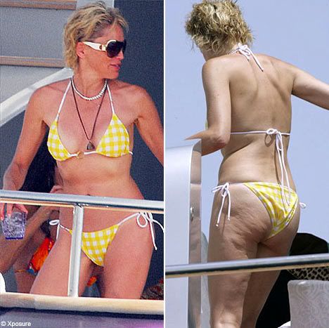 sharon stone cellulite